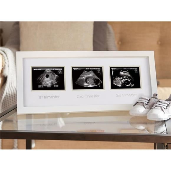 Trimester Progression Sonogram Picture Frame, Milestone Keepsake  Photo Frame - Picture 2 of 6